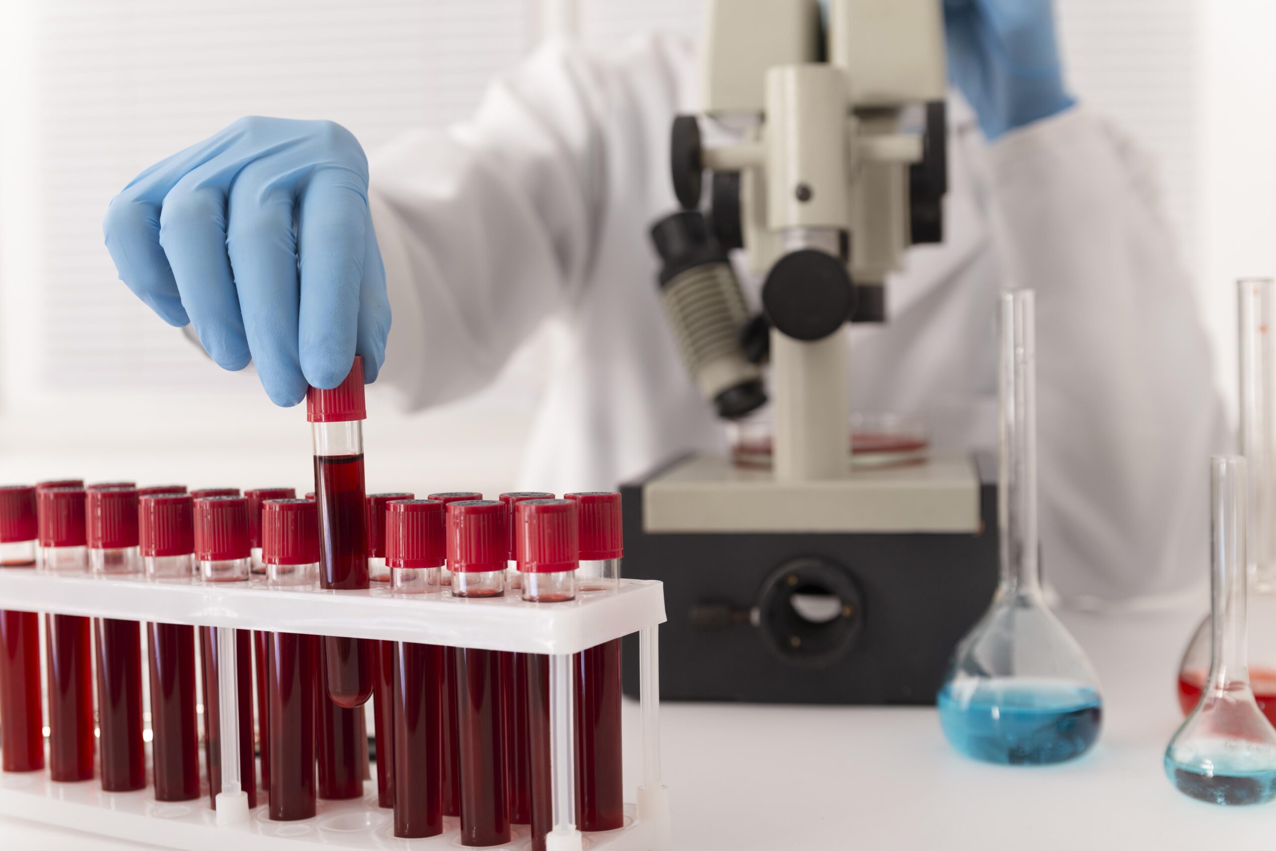 coronavirus-blood-samples-arrangement-lab